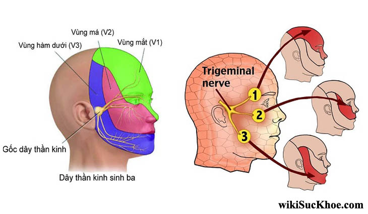 Giải thích bệnh dây thần kinh tam thoa là gì?